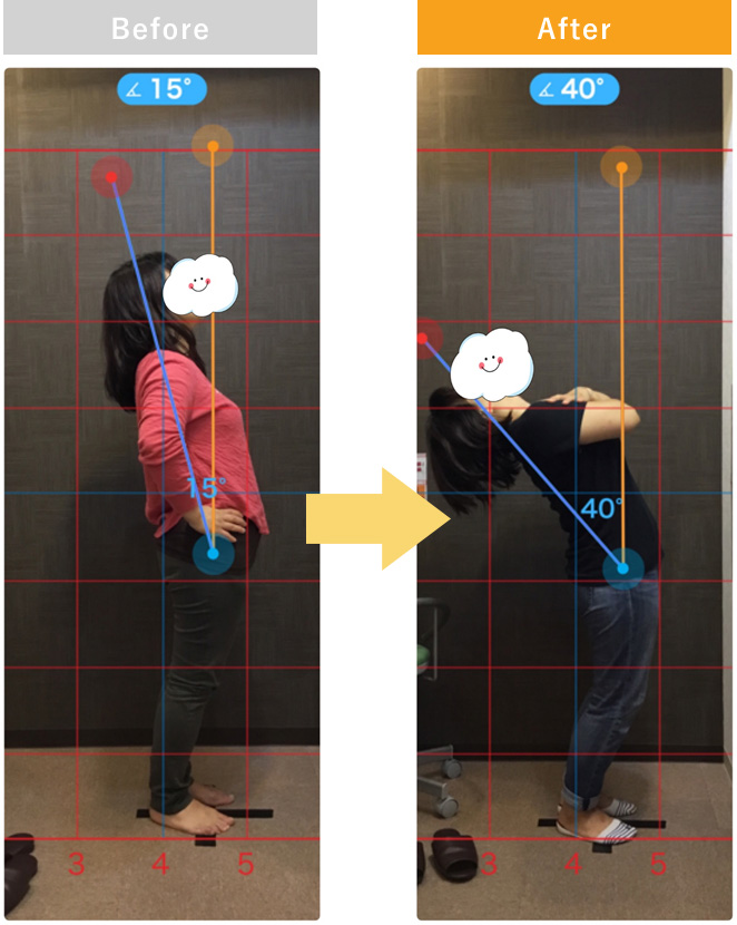 数年越しの腰痛がたった1回で激減した女性のお客様