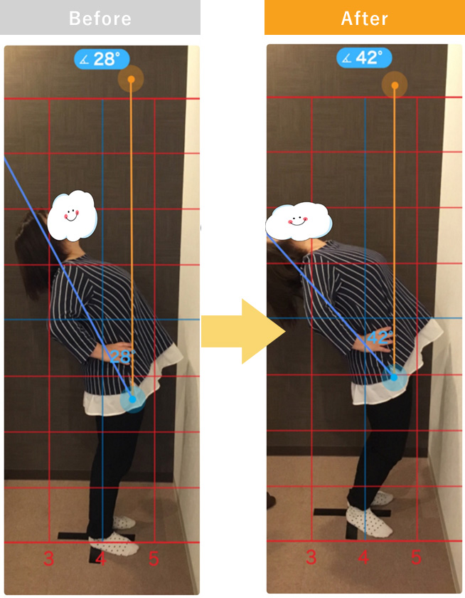 ぎっくり腰でお悩みだったという女性の患者様